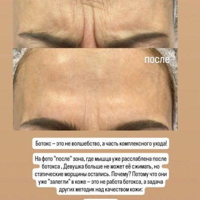 Chuyên gia thẩm mỹ liên tục nâng cao chuyên môn, chuyên gia chân thành Julia, @NEO_GEO_Beauty