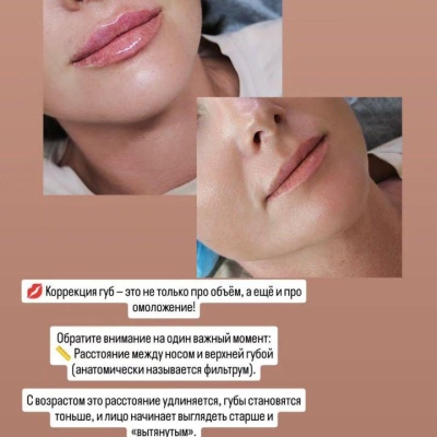 Chuyên gia thẩm mỹ liên tục nâng cao chuyên môn, chuyên gia chân thành Julia, @NEO_GEO_Beauty