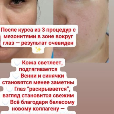 Chuyên gia thẩm mỹ liên tục nâng cao chuyên môn, chuyên gia chân thành Julia, @NEO_GEO_Beauty