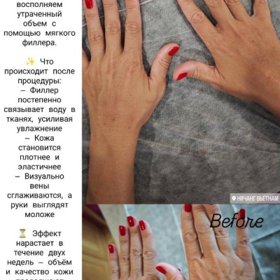 Chuyên gia thẩm mỹ liên tục nâng cao chuyên môn, chuyên gia chân thành Julia, @NEO_GEO_Beauty