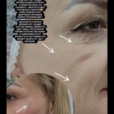 Chuyên gia thẩm mỹ liên tục nâng cao chuyên môn, chuyên gia chân thành Julia, @NEO_GEO_Beauty