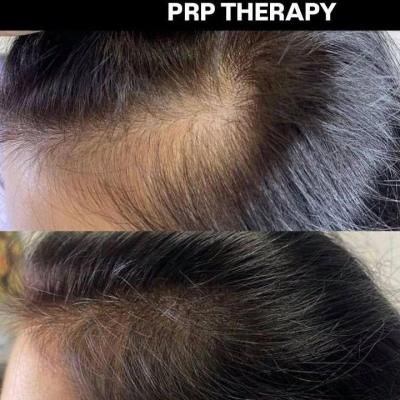 Chuyên gia làm đẹp luôn nâng cao chuyên môn, chuyên gia chân thành Julia, @NEO_GEO_Beauty