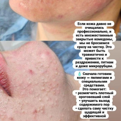 Chuyên gia làm đẹp luôn nâng cao chuyên môn, chuyên gia chân thành Julia, @NEO_GEO_Beauty