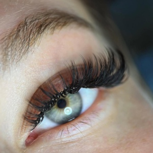 Tia (+ đến âm lượng)